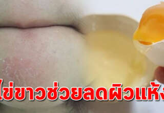 3 สูตร แก้ผิวแห้งลอกเป็นขุยด้วยไข่ขาว เหมาะกับผิวแห้งมาก