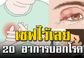 สังเกตไว้เลย 20 อาการบ อ กโ ร ค ที่คุณไม่ควรมองข้าม